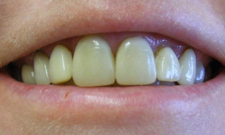 Dr. Fairfax & Associates Family Dentistry Dr. Fairfax & Associates Family Dentistry