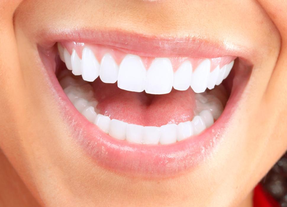 Up Close Smile | Invisalign in Fairfax Up Close Smile | Invisalign in Fairfax
