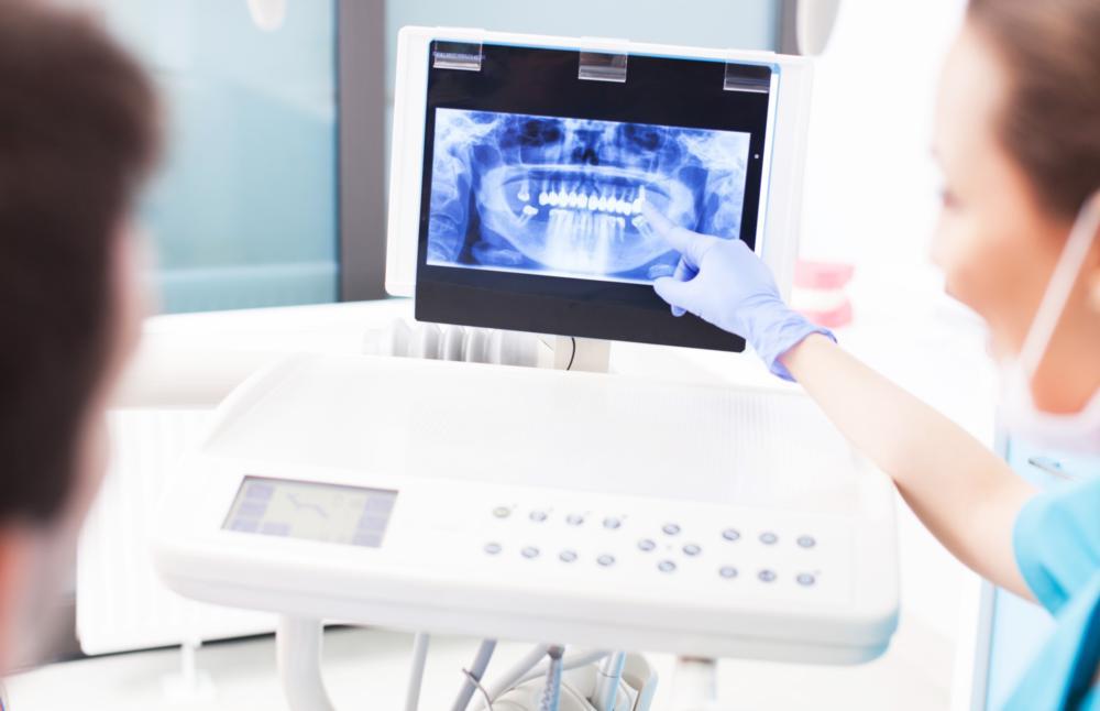 Dentist Explaining X-Ray Results | Crowns in Fairfax Dentist Explaining X-Ray Results | Crowns in Fairfax